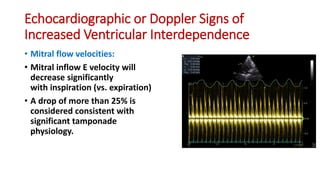Interdependent Inflow Cardiac Tamponade.pdf