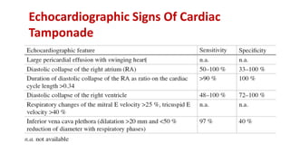Echocardiographic Signs Of Cardiac
Tamponade
 