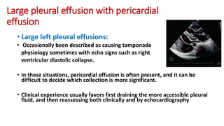 Large pleural effusion with pericardial
effusion
• Large left pleural effusions:
• Occasionally been described as causing tamponade
physiology sometimes with echo signs such as right
ventricular diastolic collapse.
• In these situations, pericardial effusion is often present, and it can be
difficult to decide which collection is more significant.
• Clinical experience usually favors first draining the more accessible pleural
fluid, and then reassessing both clinically and by echocardiography
 