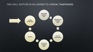 Myocardial
Infarction
(MI):
Weakening of
the Heart
Wall:
Post-MI
Inflammation:
Thinning of
the Heart
Wall:
Rupture
Cardiac
Tamponade