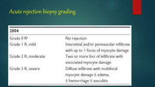 Acute rejection biopsy grading
 