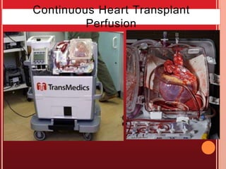 Continuous Heart Transplant
Perfusion
 