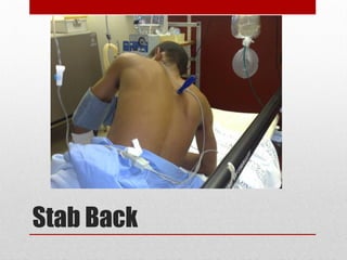 Stab Back
 