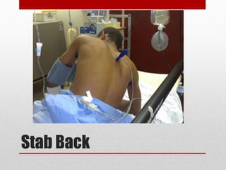 Stab Back
 
