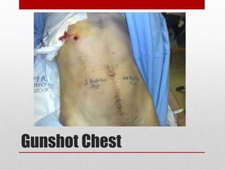 Gunshot Chest
 