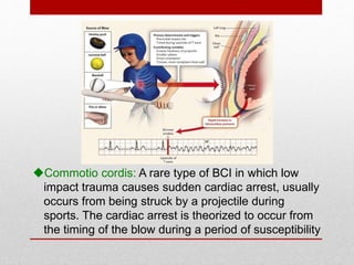 Commotio cordis: A rare type of BCI in which low
impact trauma causes sudden cardiac arrest, usually
occurs from being struck by a projectile during
sports. The cardiac arrest is theorized to occur from
the timing of the blow during a period of susceptibility
 