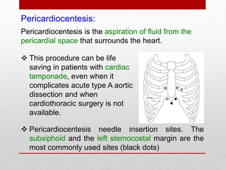 Pericardiocentesis:
 Pericardiocentesis needle insertion sites. The
subxiphoid and the left sternocostal margin are the
most commonly used sites (black dots)
Pericardiocentesis is the aspiration of fluid from the
pericardial space that surrounds the heart.
 This procedure can be life
saving in patients with cardiac
tamponade, even when it
complicates acute type A aortic
dissection and when
cardiothoracic surgery is not
available.
 