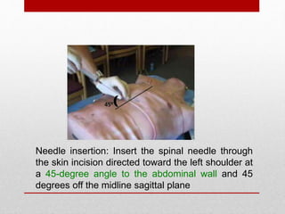 Needle insertion: Insert the spinal needle through
the skin incision directed toward the left shoulder at
a 45-degree angle to the abdominal wall and 45
degrees off the midline sagittal plane
 