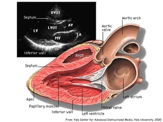 Cardiac Us | PPT