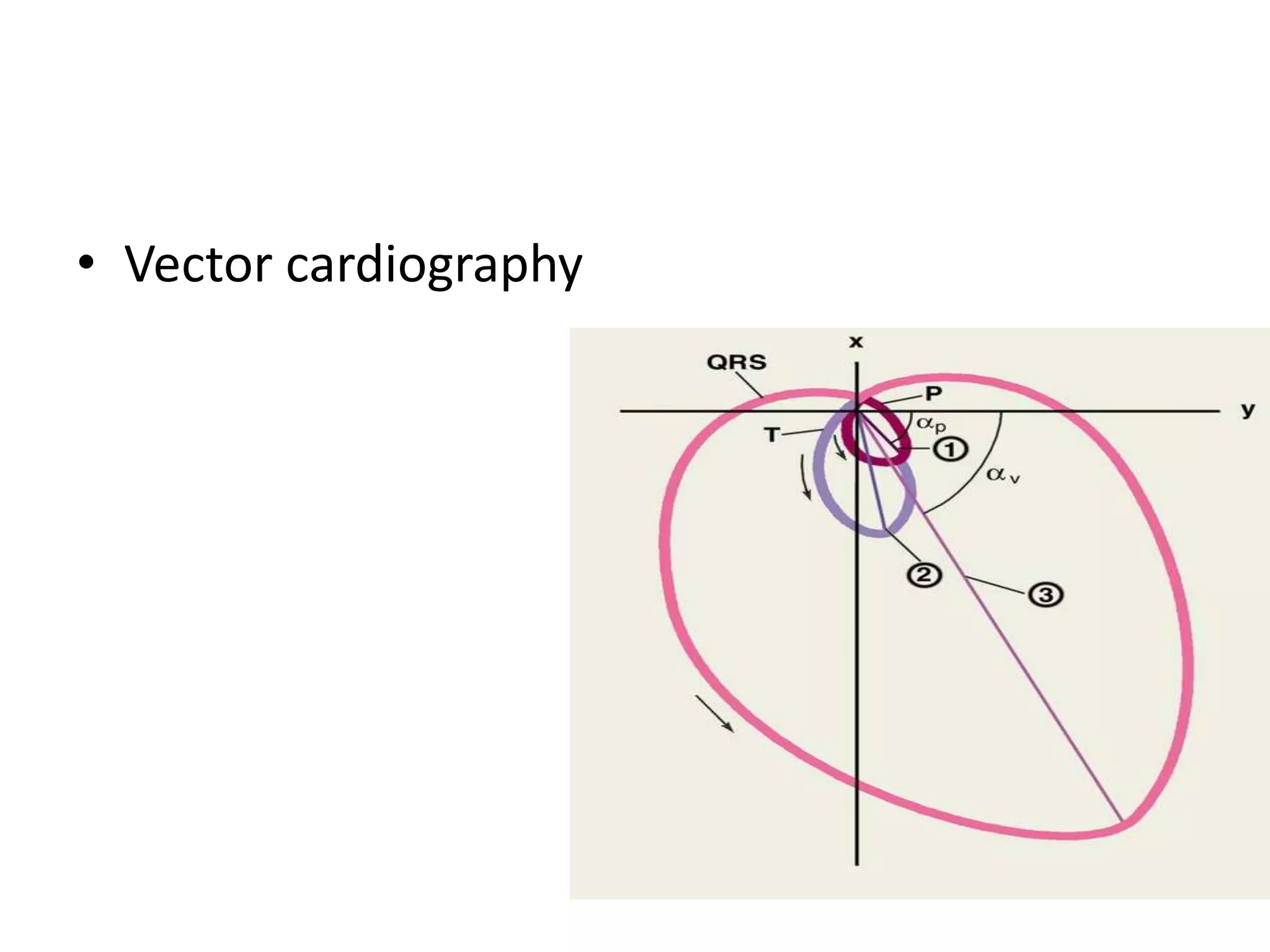 • Vector cardiography
 