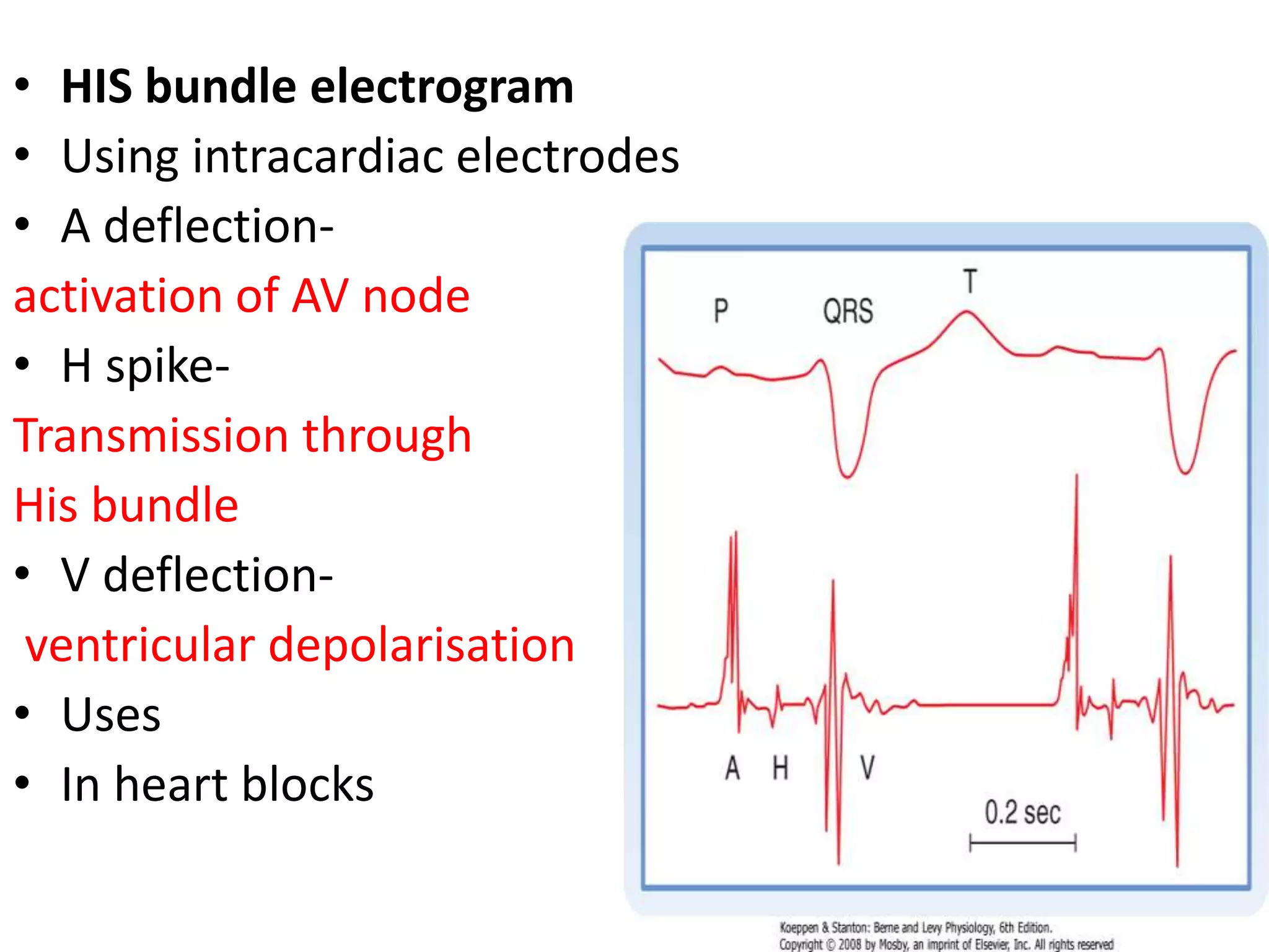 • HIS bundle electrogram
• Using intracardiac electrodes
• A deflection-
activation of AV node
• H spike-
Transmission through
His bundle
• V deflection-
ventricular depolarisation
• Uses
• In heart blocks
 