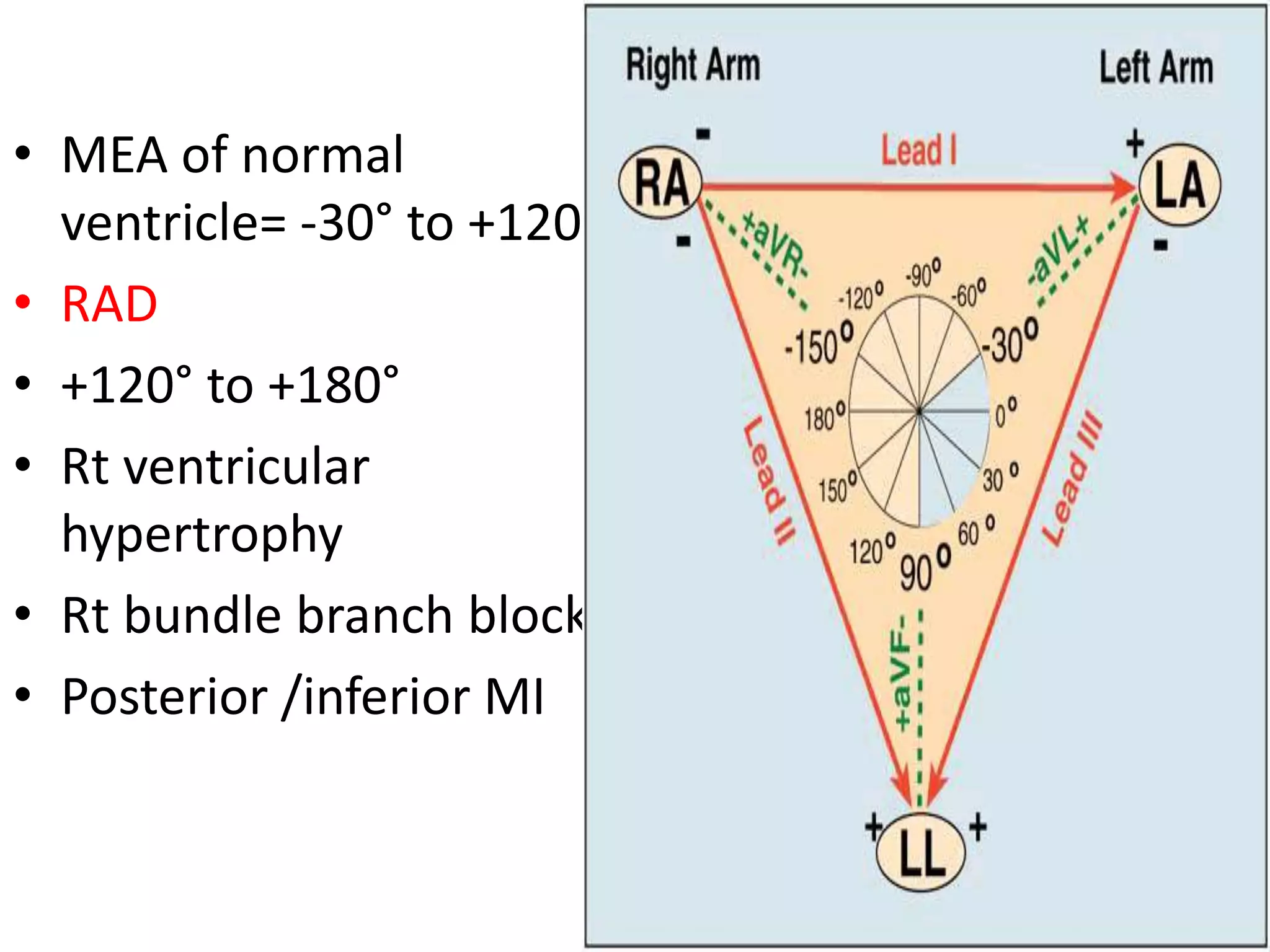 • MEA of normal
ventricle= -30° to +120°
• RAD
• +120° to +180°
• Rt ventricular
hypertrophy
• Rt bundle branch block
• Posterior /inferior MI
 