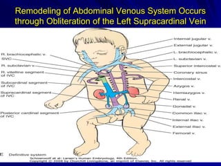 Remodeling of Abdominal Venous System Occurs
through Obliteration of the Left Supracardinal Vein

 
