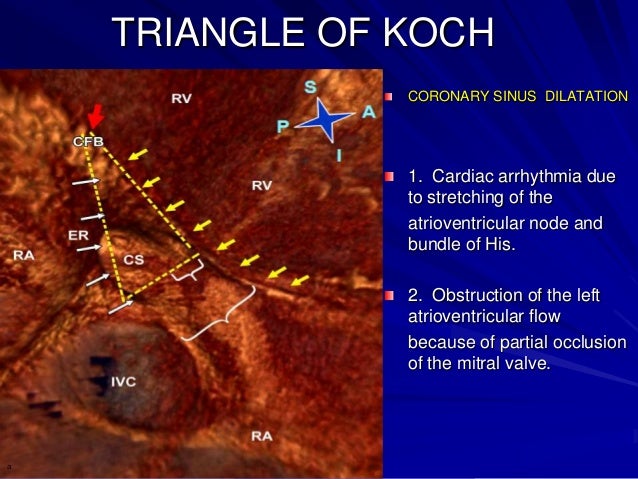 Cardiac venous system