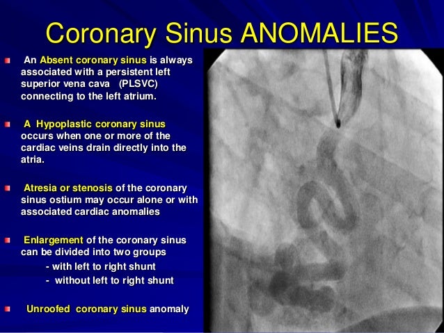 View Coronary Sinus Anatomy Ppt Background