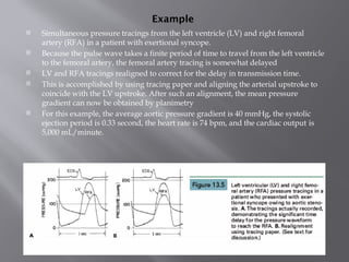 Cardiac Ventriculography - DR SANJAY.pptx