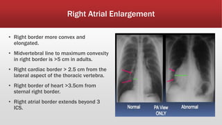 Cardiac X-ray .pptx