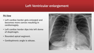 Cardiac X-ray .pptx