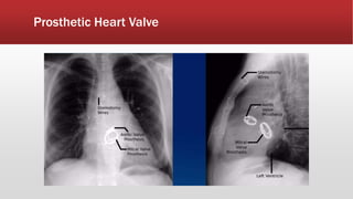 Cardiac X-ray .pptx
