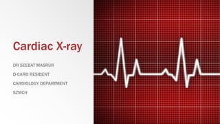 Cardiac X-ray
DR SEEBAT MASRUR
D-CARD RESIDENT
CARDIOLOGY DEPARTMENT
SZMCH
 