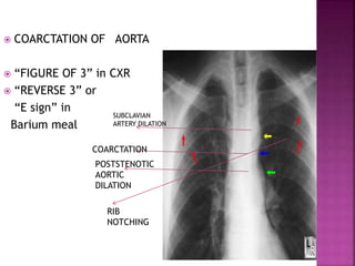 CARDIAC X RAY new.pptx