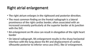 Radiographic approach to cardiac xray presentation.pptx