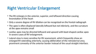 Radiographic approach to cardiac xray presentation.pptx