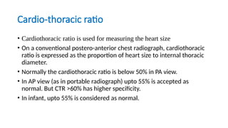 Radiographic approach to cardiac xray presentation.pptx
