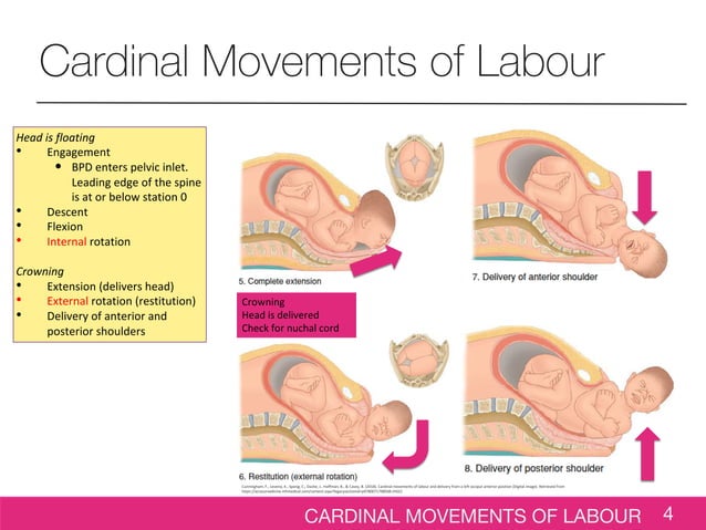 7 cardinal movements of labor expulsion
