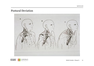Postural Deviation
April 28, 2016
British Consulate , Chicago IL 67
• Impaired Associates Use ~15% More Force
• Fatigue Can Contribute to Injury
• Dehydration May Be Linked to Muscle Tears
 