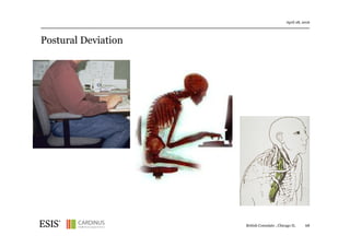 Postural Deviation
April 28, 2016
British Consulate , Chicago IL 68
 