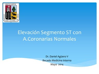 Elevación Segmento ST con 
A.Coronarias Normales 
Dr. Daniel Agüero V 
Becado Medicina Interna 
Mayo 2014 
 