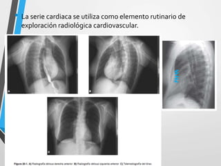 Cardio | PPTX