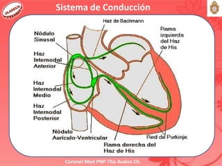 Coronel Med PNP Tito Avalos Ch.
Sistema de Conducción
 