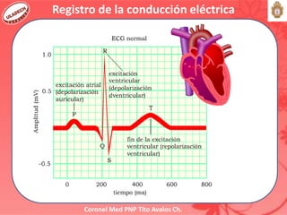 Coronel Med PNP Tito Avalos Ch.
Registro de la conducción eléctrica
 