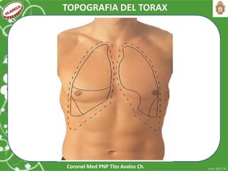 Coronel Med PNP Tito Avalos Ch.
TOPOGRAFIA DEL TORAX
 