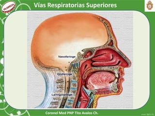 Coronel Med PNP Tito Avalos Ch.
Vías Respiratorias Superiores
 