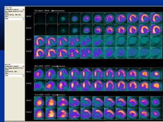 Cardio respiratory nuclear imaging ihab - copy