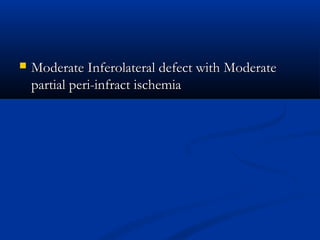 Moderate Inferolateral defect with ModerateModerate Inferolateral defect with Moderate
partial peri-infract ischemiapartial peri-infract ischemia
 