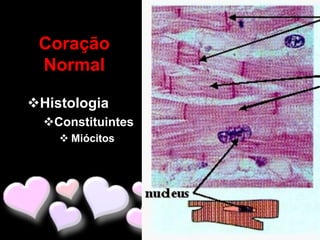 Coração
 Normal

Histologia
  Constituintes
     Miócitos
 