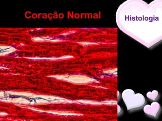 Coração Normal   Histologia
 