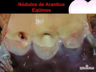 Nódulos de Arantius
     Eqüinos
 