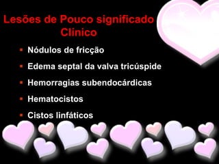 Lesões de Pouco significado
          Clínico
   Nódulos de fricção
   Edema septal da valva tricúspide
   Hemorragias subendocárdicas
   Hematocistos
   Cistos linfáticos
 
