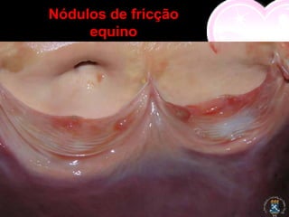 Nódulos de fricção
     equino
 