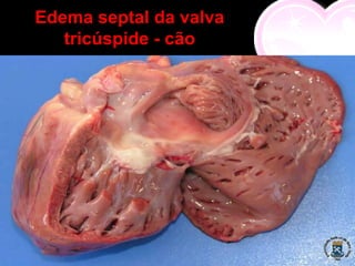 Edema septal da valva
   tricúspide - cão
 