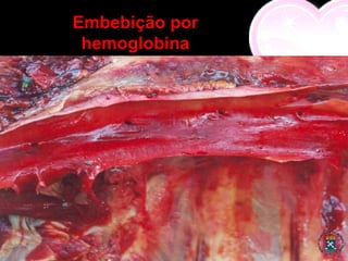 Embebição por
 hemoglobina
 