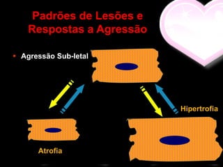 Padrões de Lesões e
    Respostas a Agressão

 Agressão Sub-letal




                           Hipertrofia




      Atrofia
 