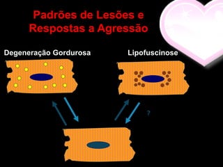 Padrões de Lesões e
      Respostas a Agressão

Degeneração Gordurosa   Lipofuscinose




                            ?
 