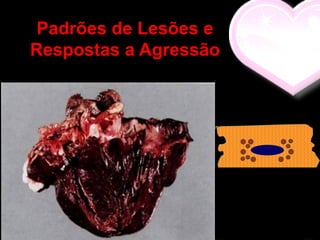 Padrões de Lesões e
Respostas a Agressão
 