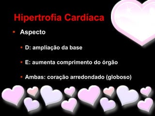Hipertrofia Cardíaca
 Aspecto

   D: ampliação da base

   E: aumenta comprimento do órgão

   Ambas: coração arredondado (globoso)
 